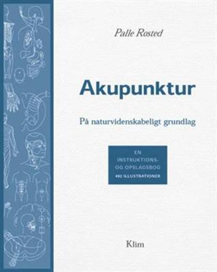 Akupunktur