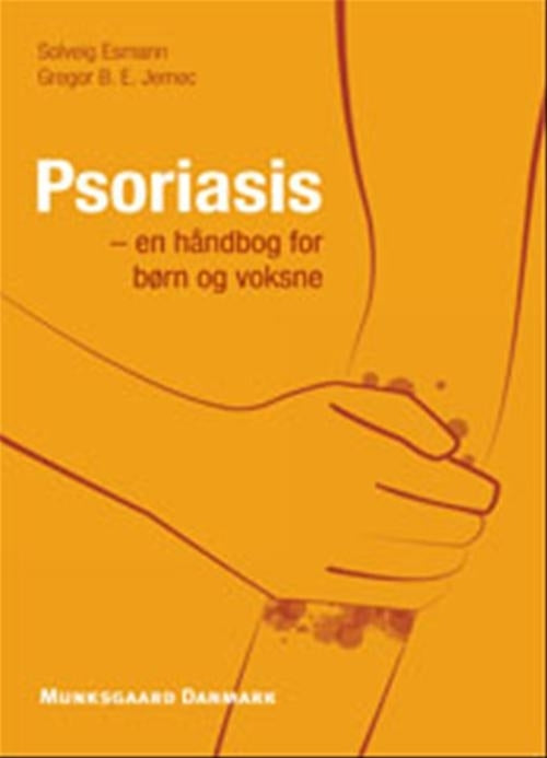 Psoriasis