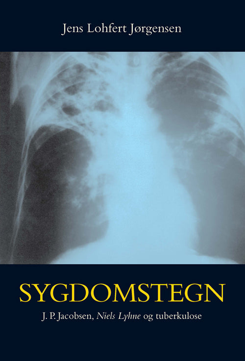 Sygdomstegn
