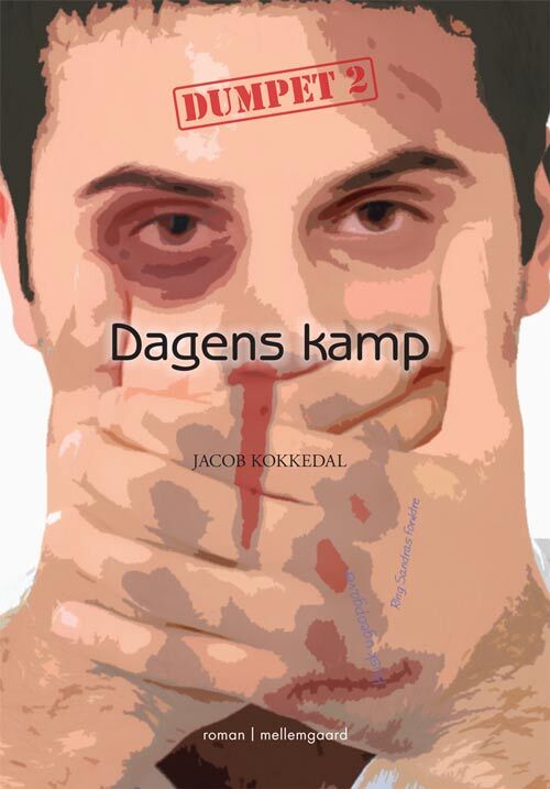Dagens kamp