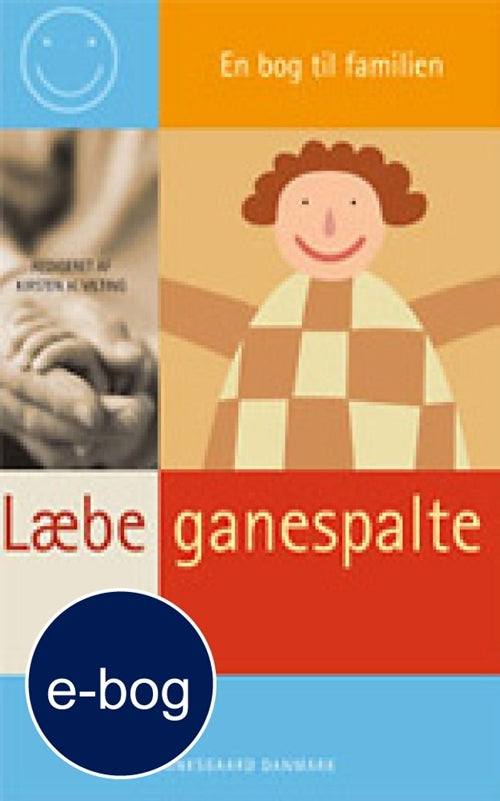 Læbe-ganespalte