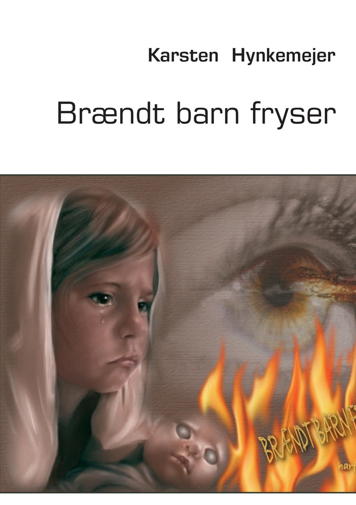 Brændt barn fryser