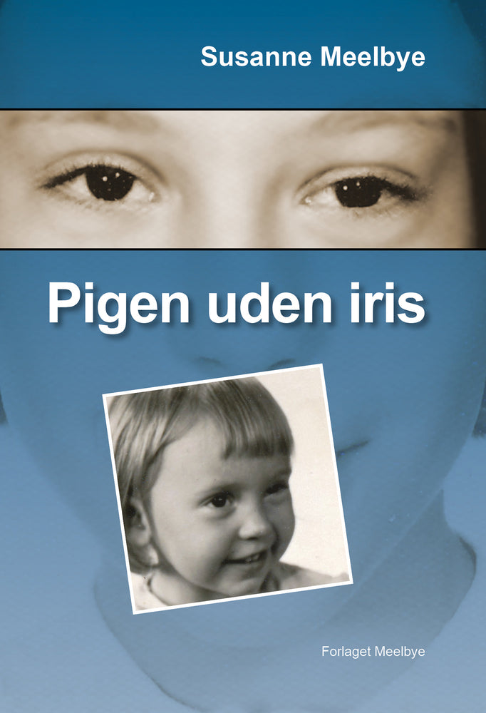 Pigen uden iris