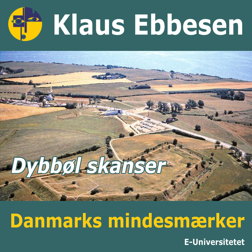Dybbøl skanser