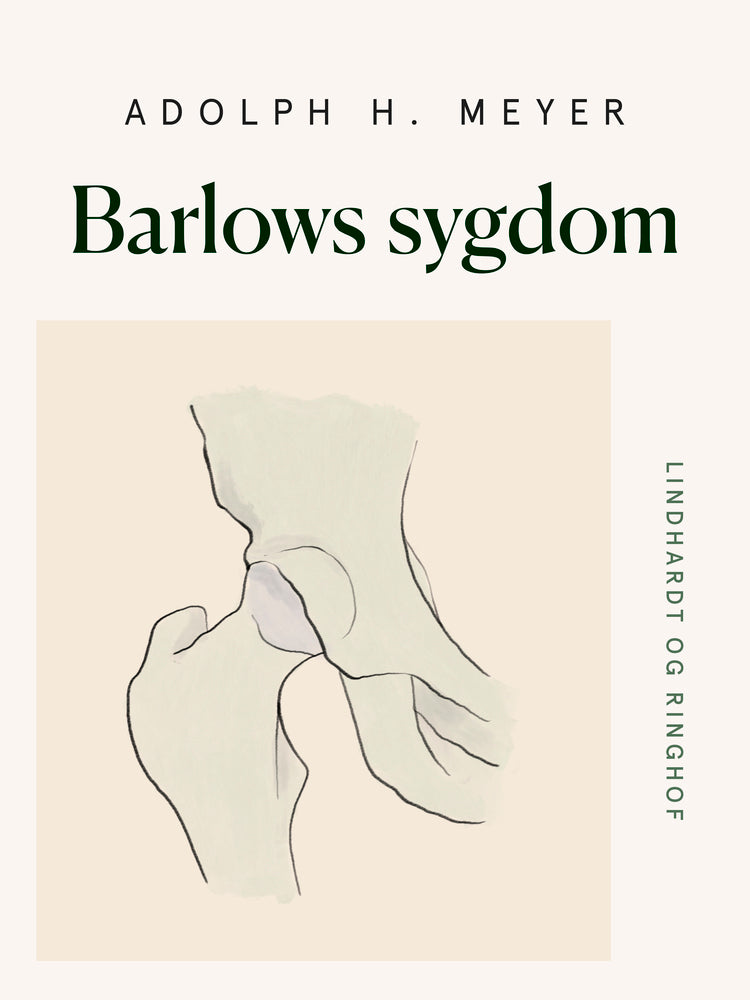 Barlows sygdom