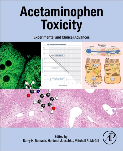 Acetaminophen Toxicity Experimental And Clinical Advances