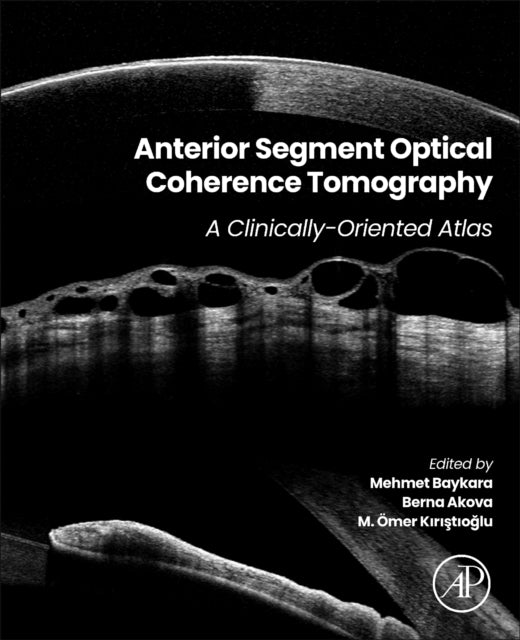 Anterior Segment Optical Coherence Tomography A Clinically-O