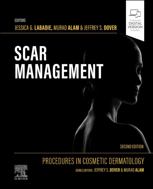 Procedures In Cosmetic Dermatology: Scar Management