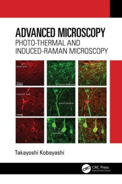 Advanced Microscopy Photo-Thermal and Induced-Raman Microsco