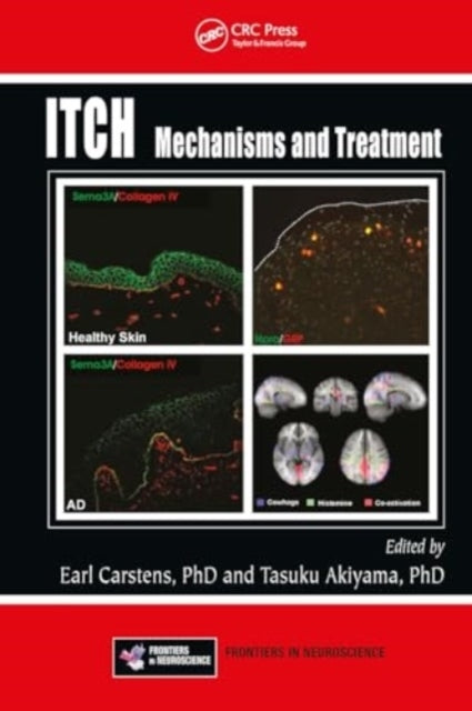 Itch Mechanisms and Treatment