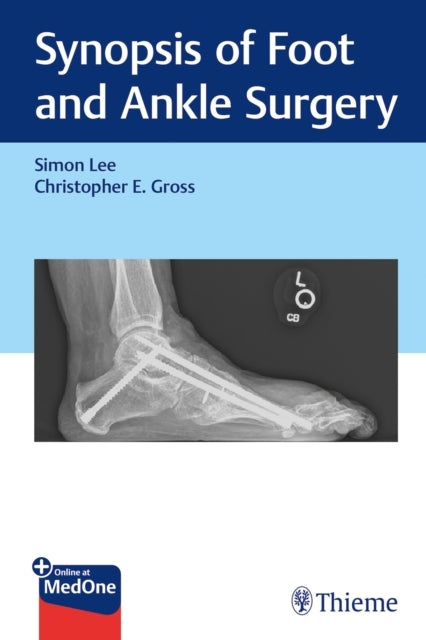 SYNOPSIS OF FOOT AND ANKLE SURGERY