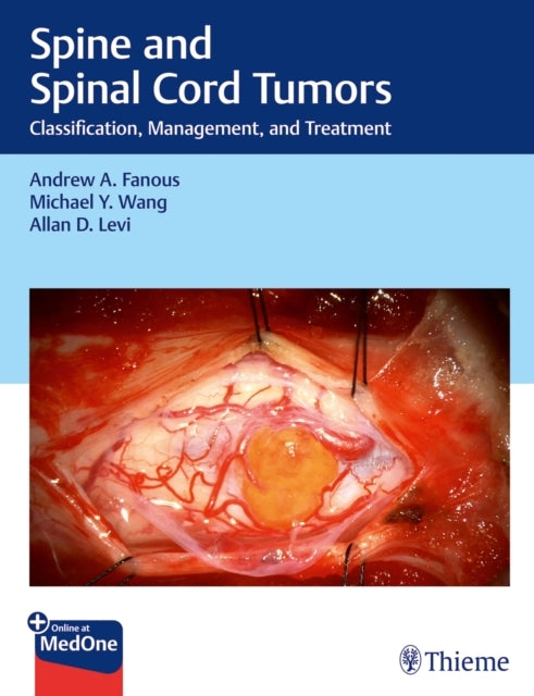 Spine And Spinal Cord Tumorsclassification Management And