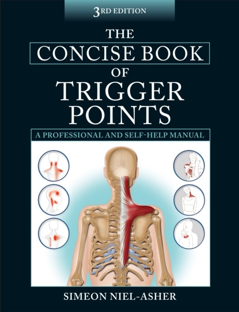 The Concise Book Of Trigger Points
